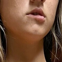 emmaontop Desnuda